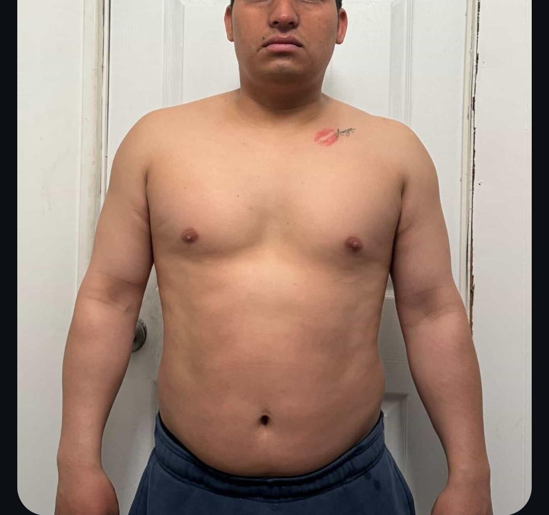Hilder before transformation